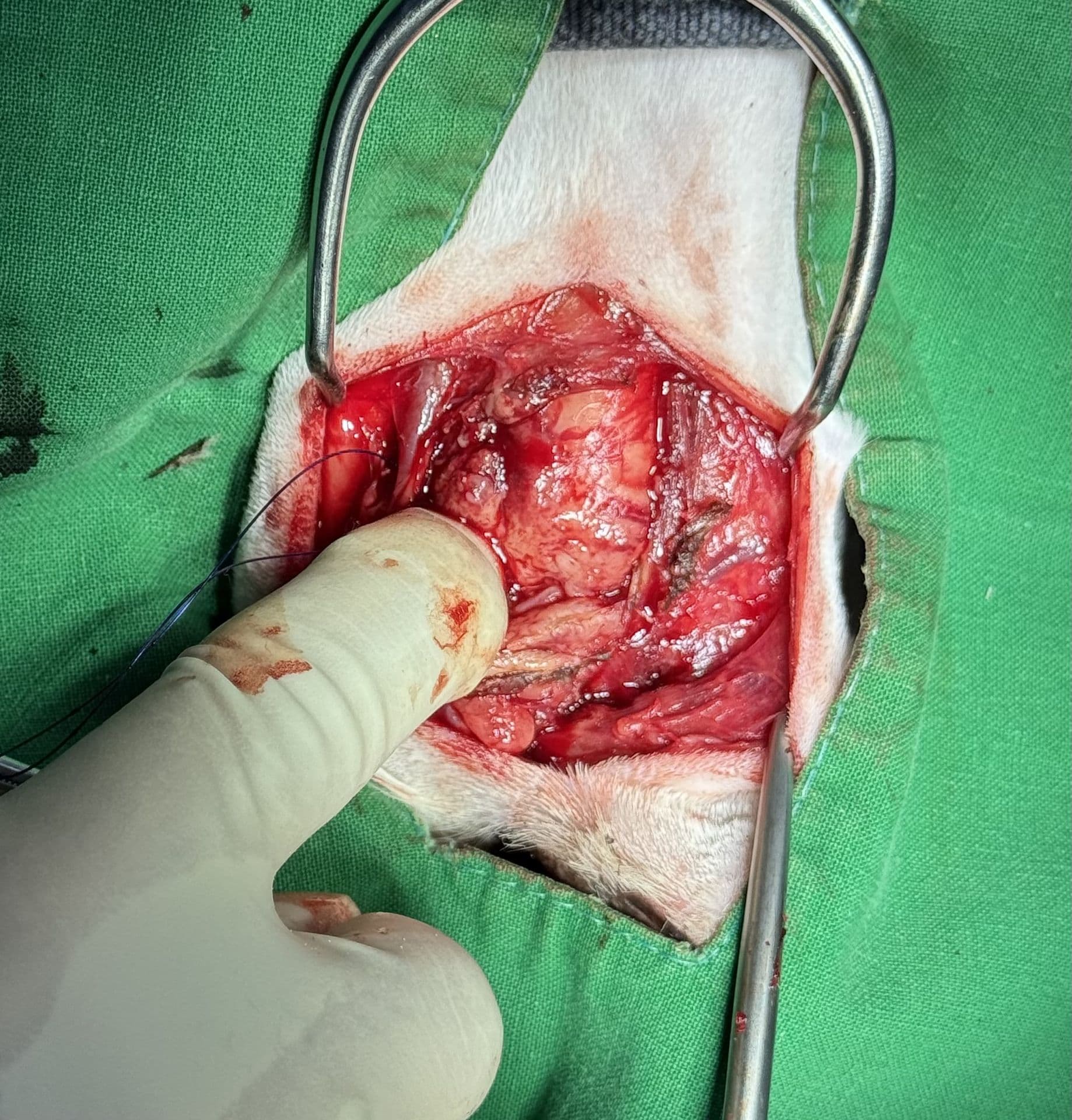 항암 치료 센터