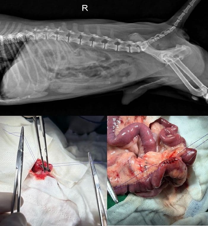 소화기 이물 제거